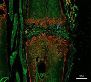 Neural stem cells injected into an injured spinal cord and differentiated into neurons (blue arrow). Jennifer Xie Lab. ©2024.